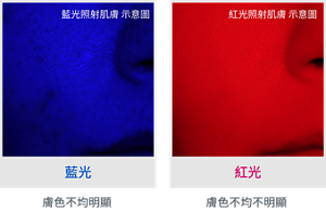 藍光照射肌膚 示意圖 藍光 膚色不均明顯 紅光照射肌膚 示意圖 紅光 膚色不均不明顯