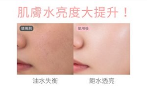 肌膚水亮度大提升！使用前 油水失衡；使用後 飽水透亮