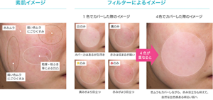 素肌イメージ 赤みムラ 暗い色ムラにごりくすみ 乾燥・粉ふき等による凹凸 フィルターによるイメージ 一色でカバーした際のイメージ 白のみ カバー力はあるが白浮き 黒のみ 赤みは治るが暗い 黄のみ 黄みがより目立つ 赤のみ 赤みがより目立つ ４色が重なると ４色でカバーした際のイメージ 色ムラもカバーしながら、赤み目立ちも抑えて、自然な血色感ある明るい肌へ