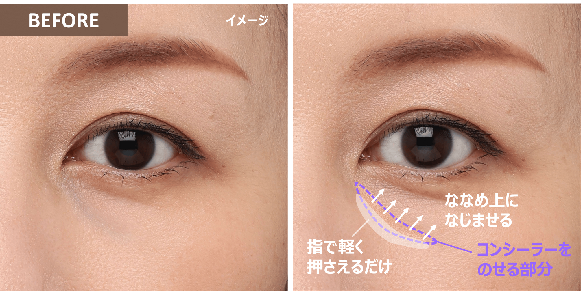 黒 クマ 消し方
