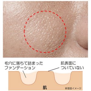 ファンデーションが毛穴落ちした肌と肌断面図でのイメージ