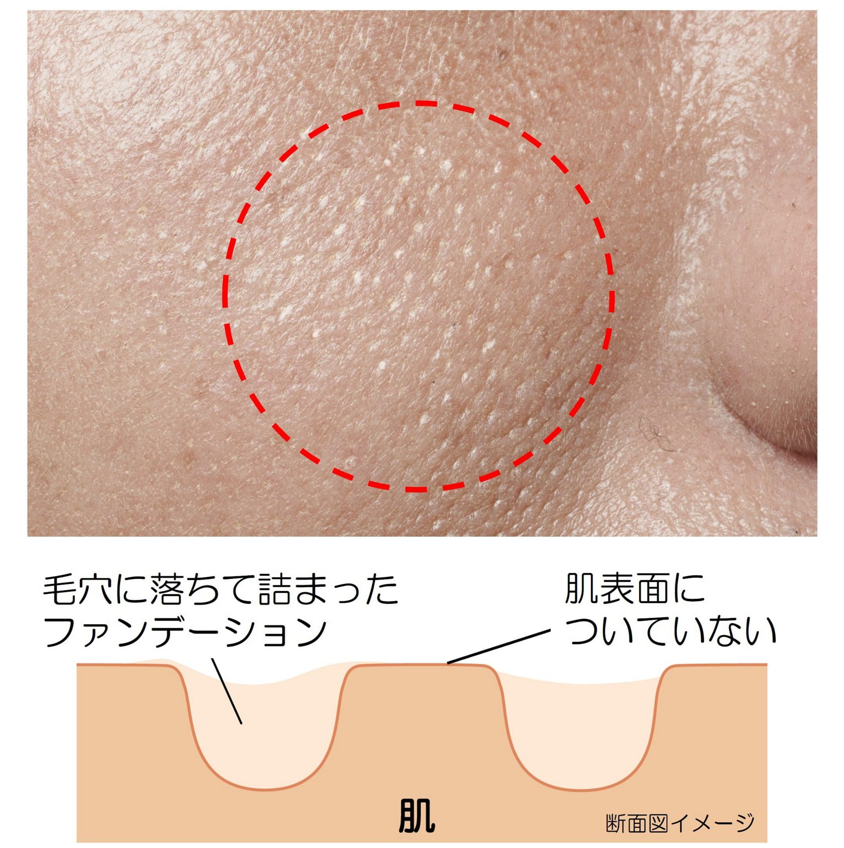 毛穴 落ち と は