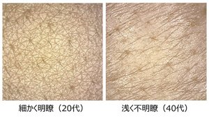 年齢による肌のキメの変化