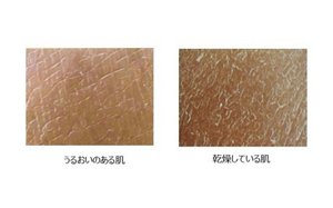 肌表面の拡大画像（うるおいのある肌、乾燥している肌）