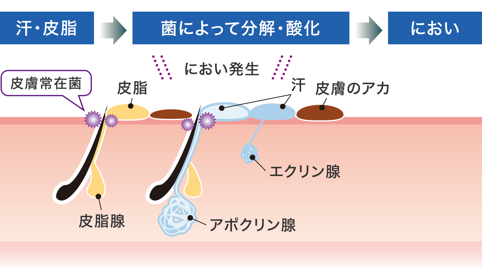 汗 酸っぱい 臭い