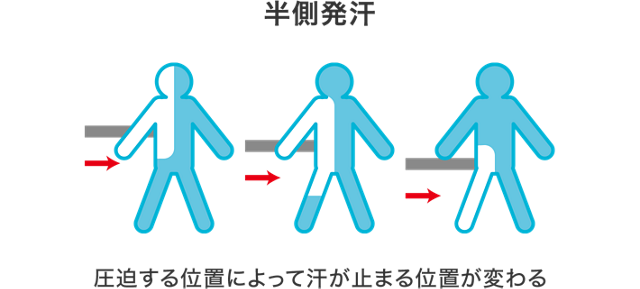 おすすめの手汗対策と制汗剤 汗と恥をかかなたいためには事前準備が大切