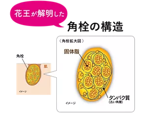 花王が解明した角栓の構造