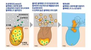 트로메타민(세정제)이 블랙헤드 내부에 침투 고체상태의 지방이 부드러워져 블랙헤드가 풀어진다 → 풀어진 블랙헤드가 미크로파우더에 흡착되어 모공 밖으로 배출됨으로써 트로메타민이 더 안쪽의 숨은 블랙헤드까지 침투 → 헹궈내면 블랙헤드 내부에 물이 들어가 블랙헤드가 스스로 붕괴!