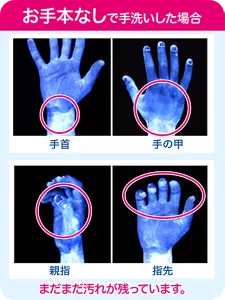 お手本なしで手洗いした場合：まだまだ汚れが残っています。