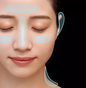 女性の顔の写真。Tゾーン、まぶたの下、首、耳の後ろが丸で囲まれている。