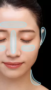 女性の顔の写真。Tゾーン、まぶたの下、首、耳の後ろが丸で囲まれている。