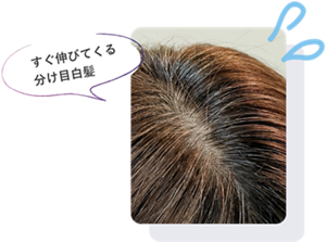 すぐ伸びてくる分け目白髪