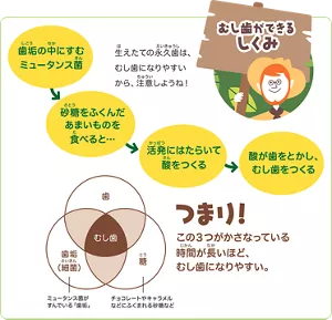 むし歯ができるしくみ：歯垢の中にすむミュータンス菌は砂糖をふくんだあまいものを食べると活発にはたらいて酸をつくります。その酸が歯をとかし、むし歯をつくってしまいます。生えたての永久歯は、むし歯になりやすいから、注意しようね。