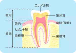 歯の構造図：歯を縦切りにした図です。歯肉から出ている上方部分を歯冠、歯肉に埋まっている部分を歯根と呼びます。歯の本体は象牙質と呼ばれる組織です。歯の中央部には血管が侵入している歯髄（神経）があり、歯の表面を被っている一番外側はエナメル質です。歯周組織は歯の周囲にある組織で歯肉、歯根膜とセメント質、歯槽骨の4つからなります。