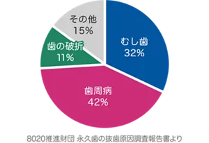歯が抜ける主な原因のグラフ：もっとも多いのは歯周病42％、続いてむし歯32％、歯の破折11％、その他15％です。（8020推進財団 永久歯の抜歯原因調査報告書より）