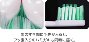 歯のすき間に毛先が入ると、フッ素入りのハミガキも同時に届く。