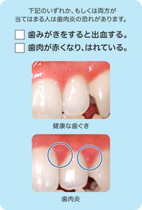 3. むし歯以外のu201cよくあるトラブルu201d  生えかわり期の歯みがきQu0026A (6 