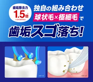 歯垢除去力1.5倍（※当社採用毛比） 独自の組み合わせ「球状毛×極細毛」で歯垢スゴ落ち！