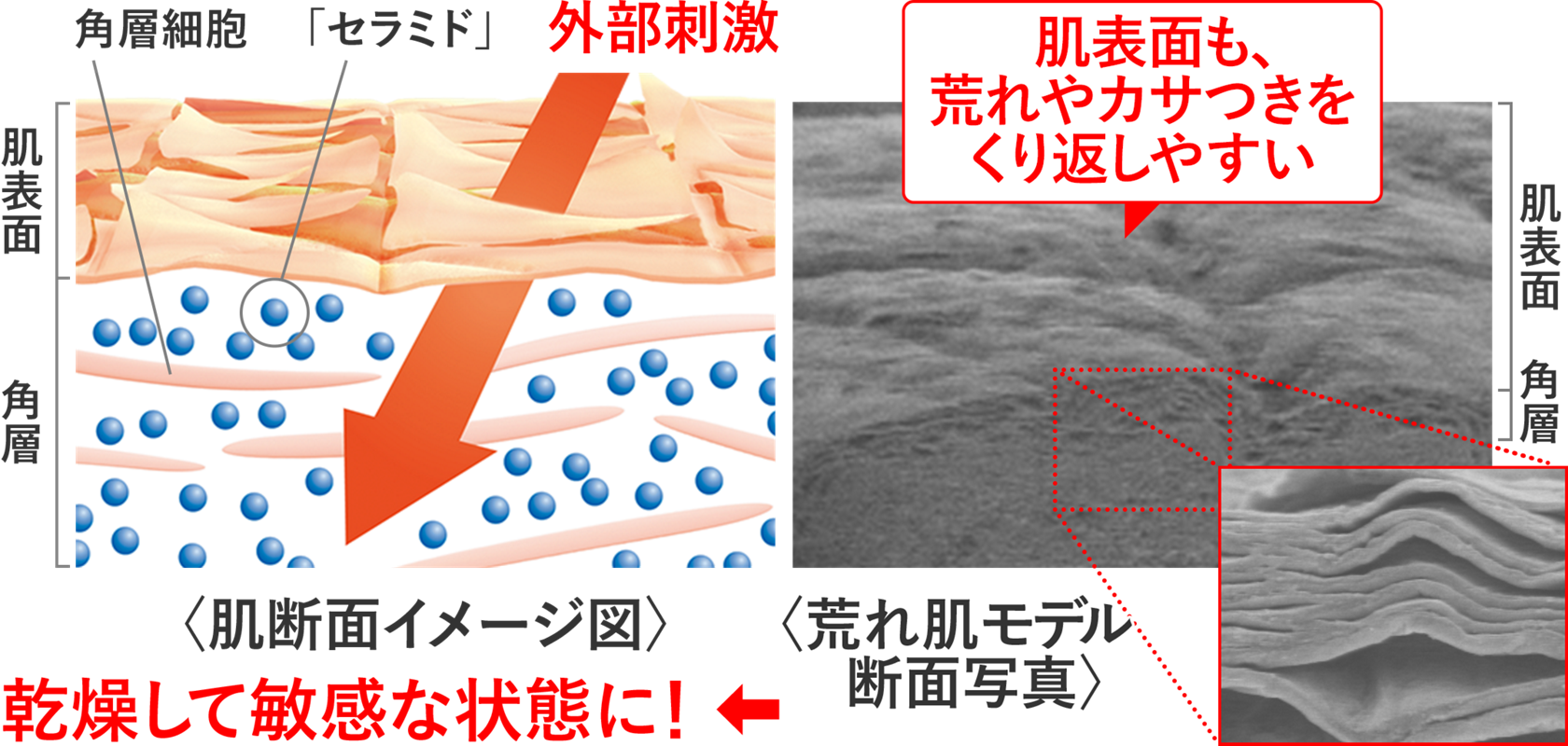 肌の必須成分 セラミド とは 肌の必須成分 セラミド とは