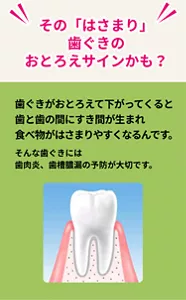 その「はさまり」歯ぐきのおとろえサインかも？　歯ぐきがおとろえて下がってくると歯と歯の間にすき間が生まれ食べ物がはさまりやすくなるんです。そんな歯ぐきには歯肉炎、歯槽膿漏の予防が大切です。
