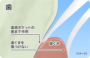 歯周ポケット（歯と歯ぐきのすき間）の奥まで作用。歯ぐきを傷つけない。