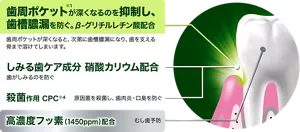 歯周ポケット(※1)が深くなるのを抑制し、歯槽膿漏を防ぐ。β-グリチルレチン酸配合。歯周ポケットが深くなると、次第に歯槽膿漏になり、歯を支える骨まで溶けてしまいます。／しみる歯ケア成分 硝酸カリウム配合。歯がしみるのを防ぐ／殺菌作用 CPC(※4)。原因菌を殺菌し、歯肉炎・口臭を防ぐ／高濃度フッ素（1450ppm）配合。むし歯予防