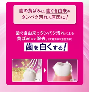 歯の黄ばみは、歯ぐき由来のタンパク汚れも原因に！歯ぐき由来のタンパク汚れによる黄ばみまで除去。歯を白くする！