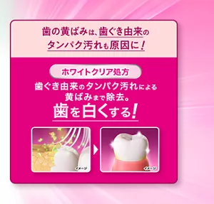 歯の黄ばみは、歯ぐき由来のタンパク汚れも原因に！ [ホワイトクリア処方] 歯ぐき由来のタンパク汚れによる黄ばみまで除去。歯を白くする！