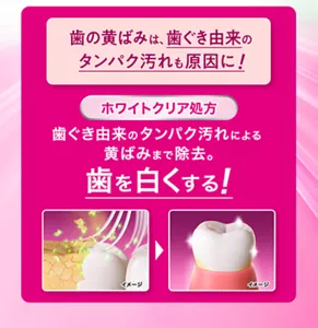 歯の黄ばみは、歯ぐき由来のタンパク汚れも原因に！ [ホワイトクリア処方] 歯ぐき由来のタンパク汚れによる黄ばみまで除去。歯を白くする！