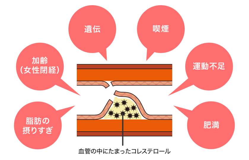 花王株式会社 知りたい 教えて コレステロール 花王株式会社 知りたい 教えて コレステロール