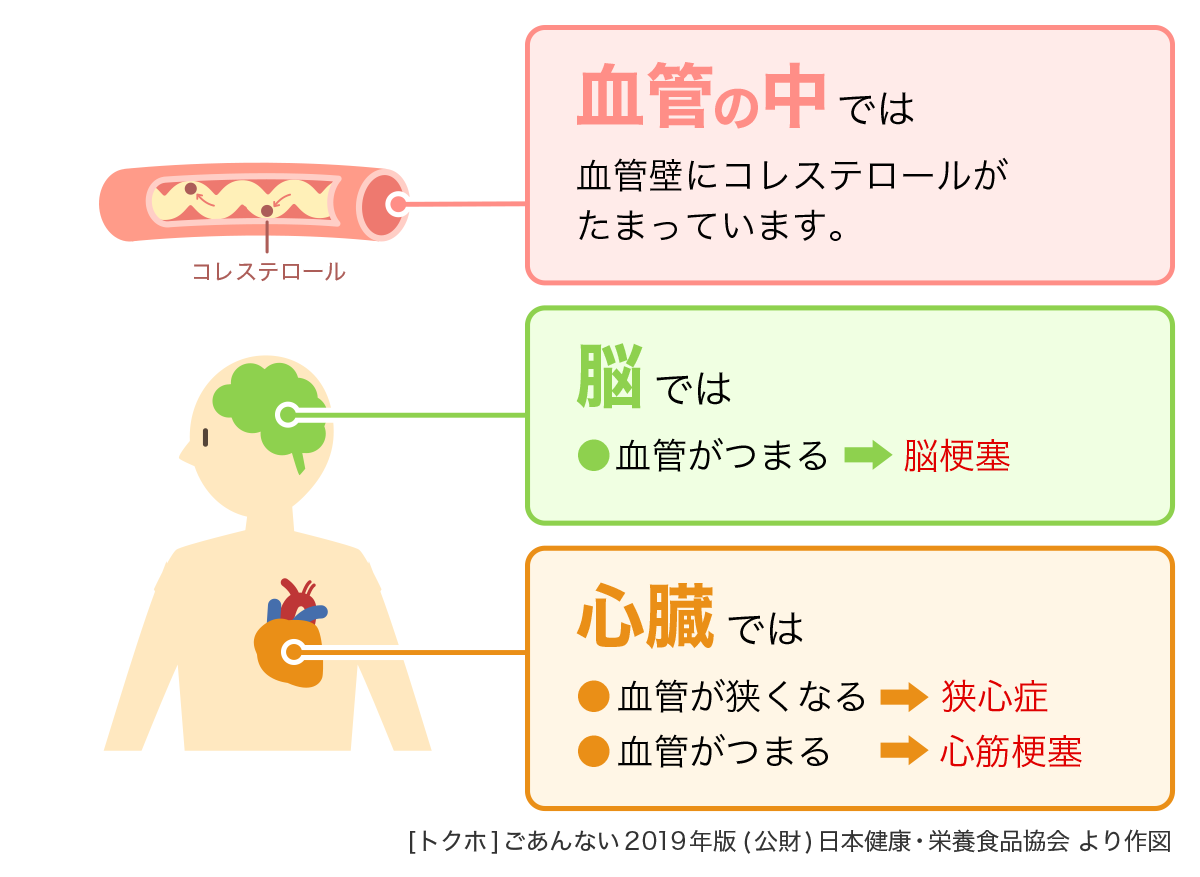 花王株式会社 コレステロールが高い原因は