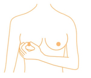 乳頭をつまんで血が混ざった分泌物が出ないかをセルフチェックしているイメージ。