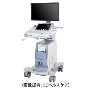 経腟超音波検査のイメージ。（画像提供：ＧＥヘルスケア）