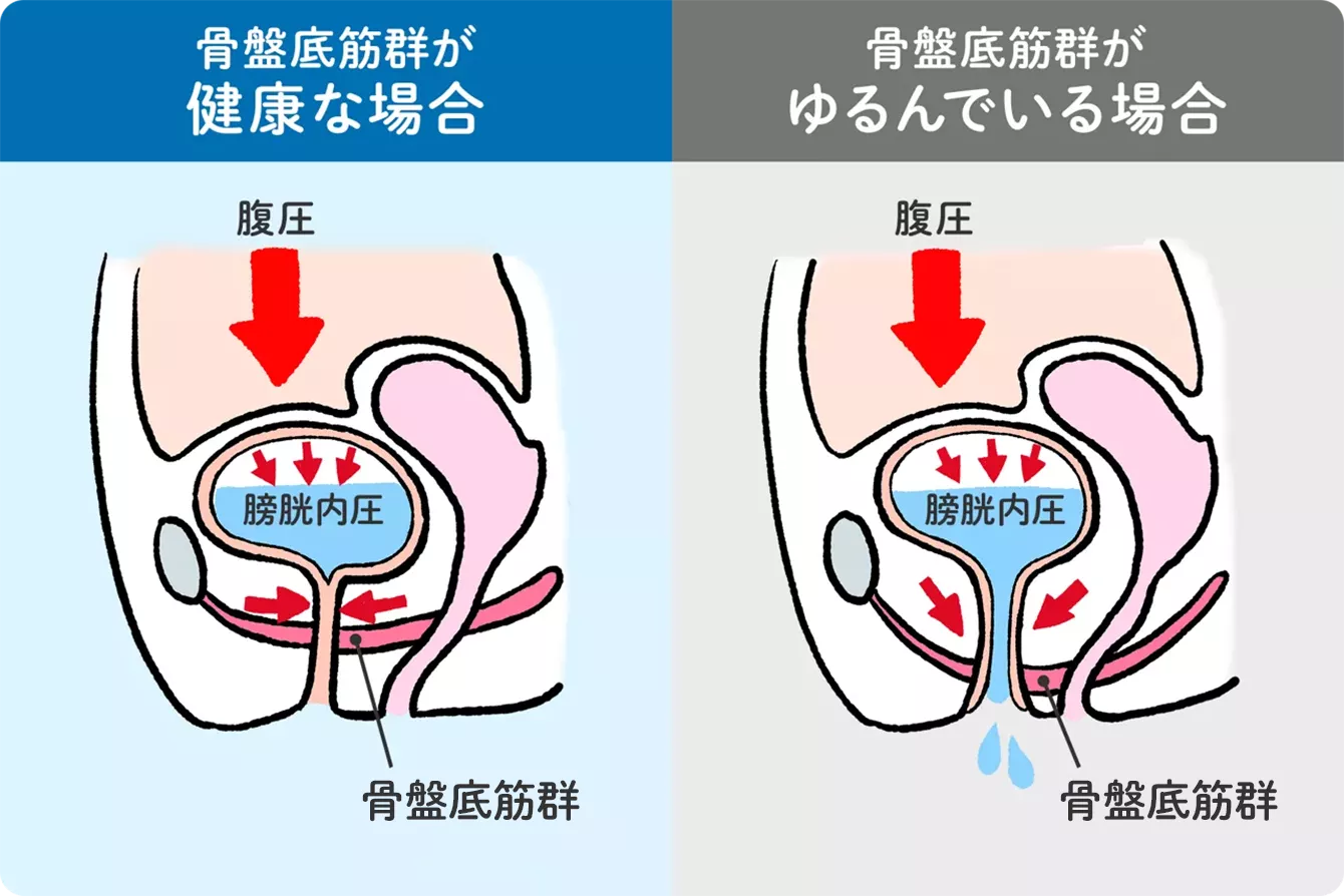 尿 が 出 にくい