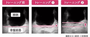 トレーニング前、トレーニング①、トレーニング②の腹部エコ―写真。二宮教授提供。
