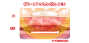 めぐりズム 医療機器 肌に直接貼るシート：痛み・こりのもとを流しさる！ イメージ：蒸気は目に見えません