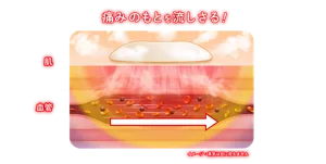 めぐりズム 医療機器 下着の内側面に貼るシート：痛みのもとを流しさる！ イメージ：蒸気は目に見えません