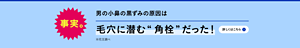 事実。男の小鼻の黒ずみ。原因は毛穴に潜む”角栓”だった！※花王調べ　詳しくはこちら