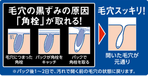毛穴の黒ずみの原因「角栓」が取れる！毛穴につまった角栓  パックが角栓をキャッチ  パックで角栓を取る 毛穴スッキリ！開いた毛穴が元通り ※パック後1〜2日で、汚れで開く前の毛穴の状態に戻ります。