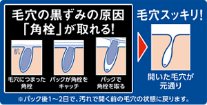 毛穴の黒ずみの原因「角栓」が取れる！毛穴につまった角栓  パックが角栓をキャッチ  パックで角栓を取る 毛穴スッキリ！開いた毛穴が元通り ※パック後1〜2日で、汚れで開く前の毛穴の状態に戻ります。