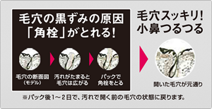 毛穴につまった黒ずみ深々キャッチ！　毛穴の黒ずみの原因「角栓」がとれる！　毛穴の断面図（モデル）、汚れがたまると毛穴は広がる、パックが角栓をとる　毛穴スッキリ！小鼻つるつる　開いた毛穴が元通り　皮脂の分泌量が多い男性は、毛穴に皮脂がたまりやすく、それが固まると、黒ずみの原因“角栓”となります。毛穴パックは奥につまった角栓でもするっととれます。