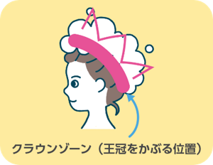 クラウンゾーン(王冠をかぶる位置)