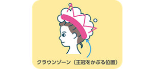 クラウンゾーン(王冠をかぶる位置)