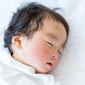 熱が出ている赤ちゃん