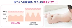 赤ちゃんの皮膚は、大人より薄くデリケート