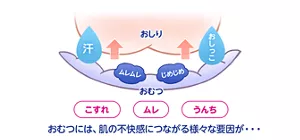 おむつには、「こすれ」「ムレ」「うんち」など、肌の不快感につながるさまざまな要因が…