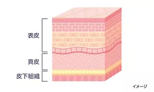 皮膚の3層構造（表皮、真皮、皮下組織）のイメージ図