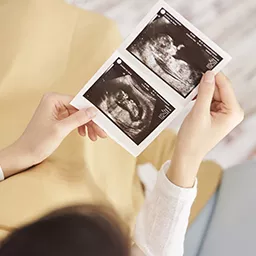 超音波写真を見る妊婦