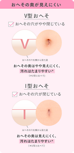 おへその奥が見えにくい　V型おへそ（おへその穴がやや閉じている） I型おへそ（おへその穴が閉じている）