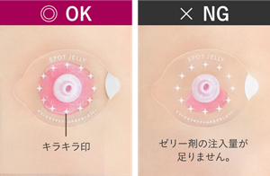 ゼリー剤の注入量目安の比較。左側はシールのキラキラ印まで満たした正しい注入量。右側はゼリー剤の注入量が足りずキラキラ印まで届いていないNGの状態。